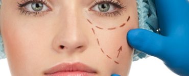 Plastic Surgery